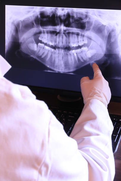 Best Emergency Tooth Extraction in Dauphin, PA