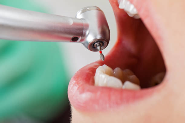 Best Emergency Treatment for Dental Infections or Abscesses in Dauphin, PA